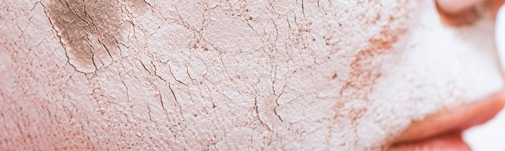 Микротрещины после стягивающей поры маски Микротрещины после стягивающей поры маски