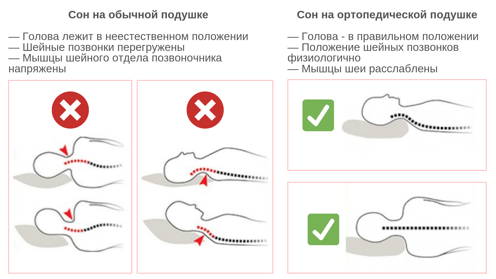 Чем отличается сон на обычной подушке и на ортопедической подушке
