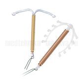 Внутриматочная спираль